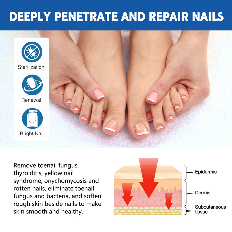 Toenail Care Patches for Targeted Nail Comfort at Home