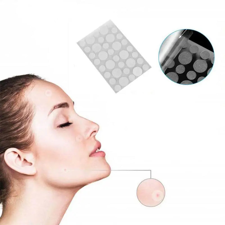 Pimple Patches, Invisible Acne Spot Covers, 36-Piece