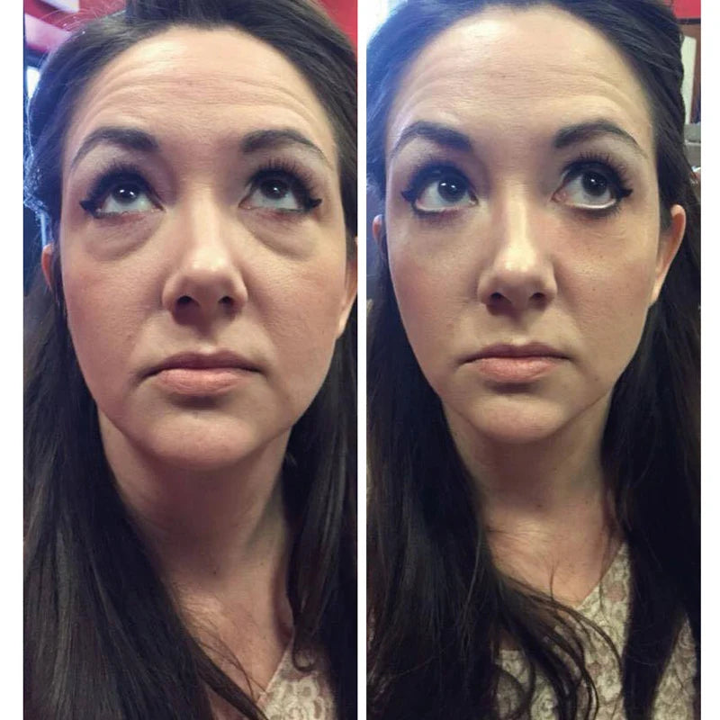 Instant Lifting Eye Cream for Puffiness & Fine Lines