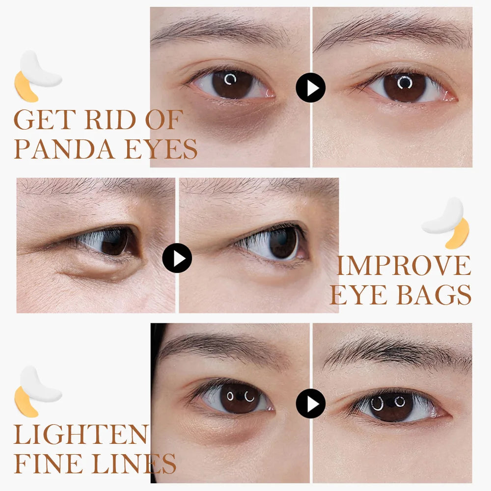 Gold Collagen Eye Patches for Brighter-Looking Eyes