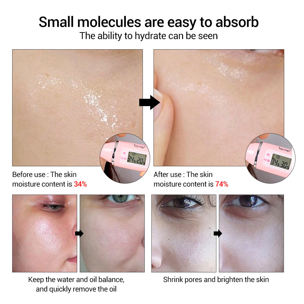Hyaluronic Acid Serum for Hydration & Clearer Skin