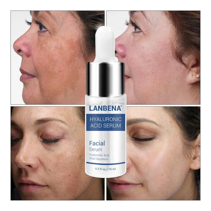 Hyaluronic Acid Serum for Hydration & Clearer Skin