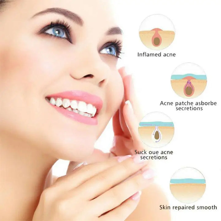 Pimple Patches, Invisible Acne Spot Covers, 36-Piece