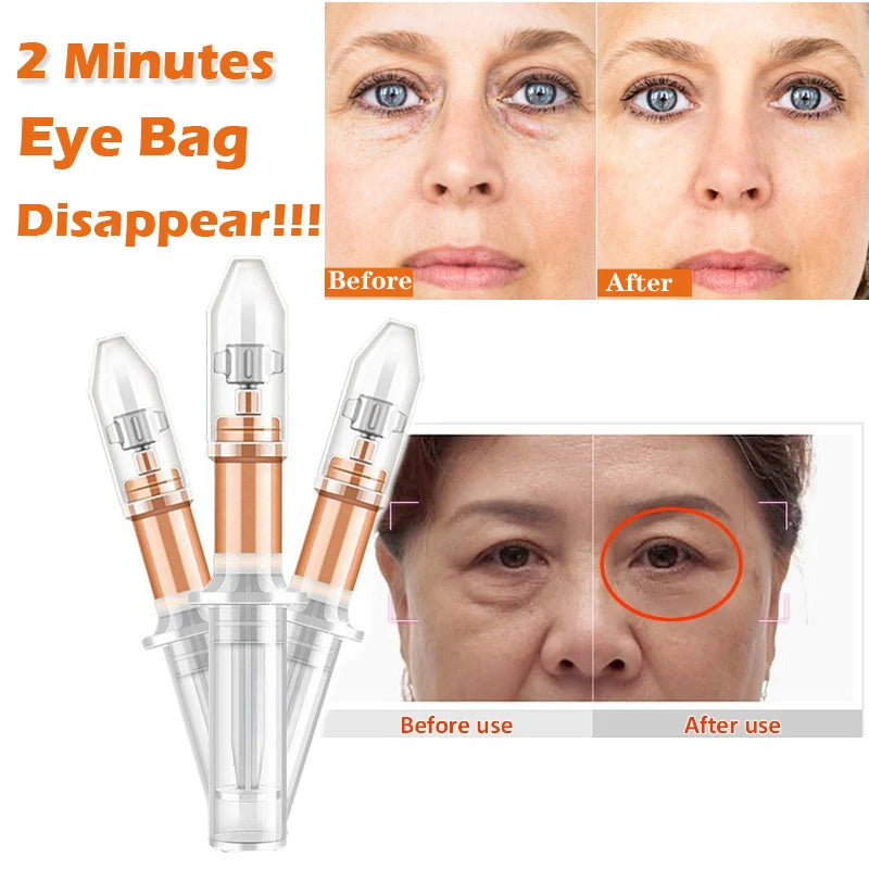 Instant Lifting Eye Cream for Puffiness & Fine Lines