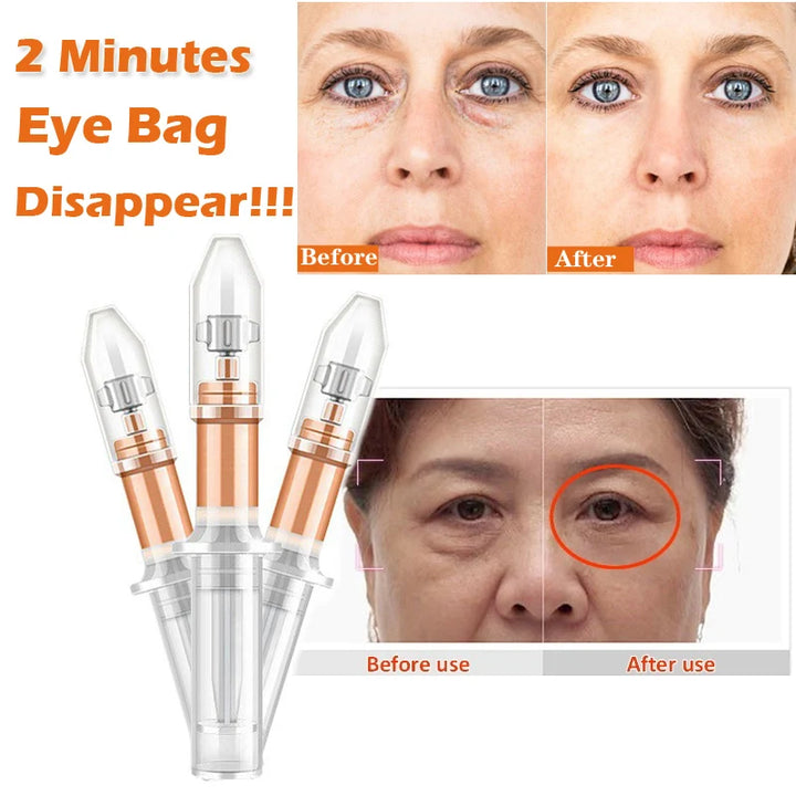 Instant Lifting Eye Cream for Puffiness & Fine Lines