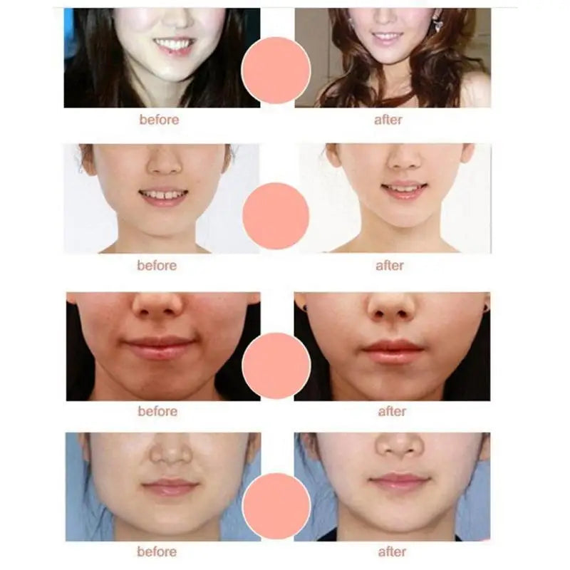 V Shape Lifting Mask — Instantly Defined Jawline & Firmer Skin