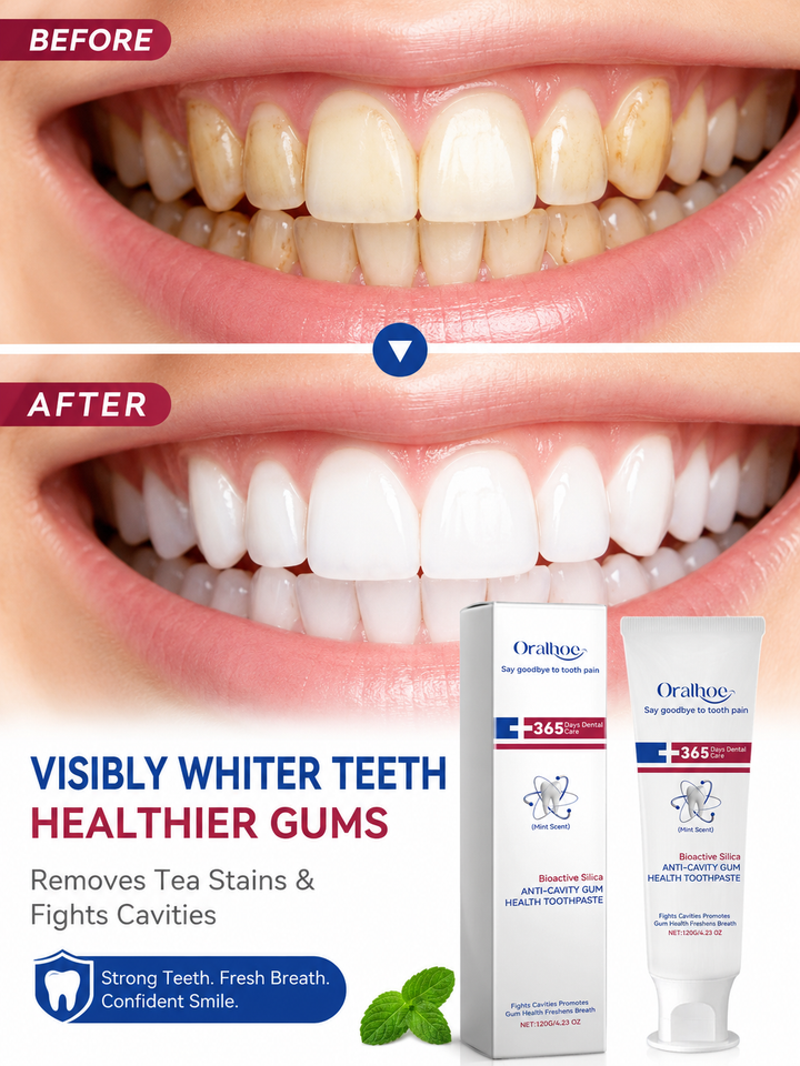Anti‑Cavity Gum Health Toothpaste — Stain‑Free, Healthy Gums
