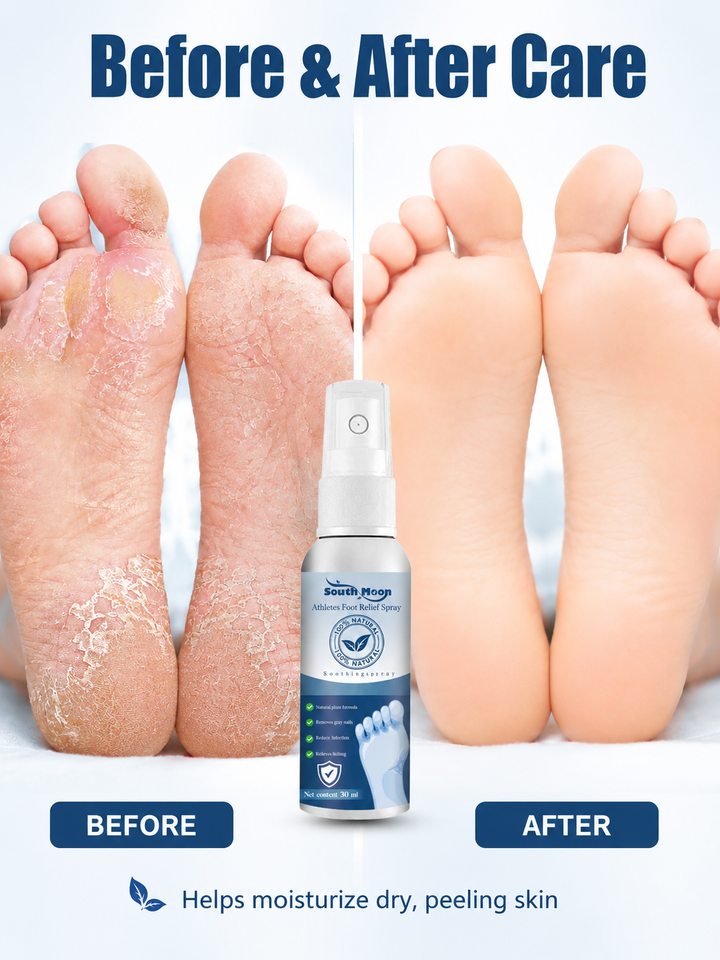 Athlete’s Foot Spray - Natural Relief for Itchy, Gray Nails