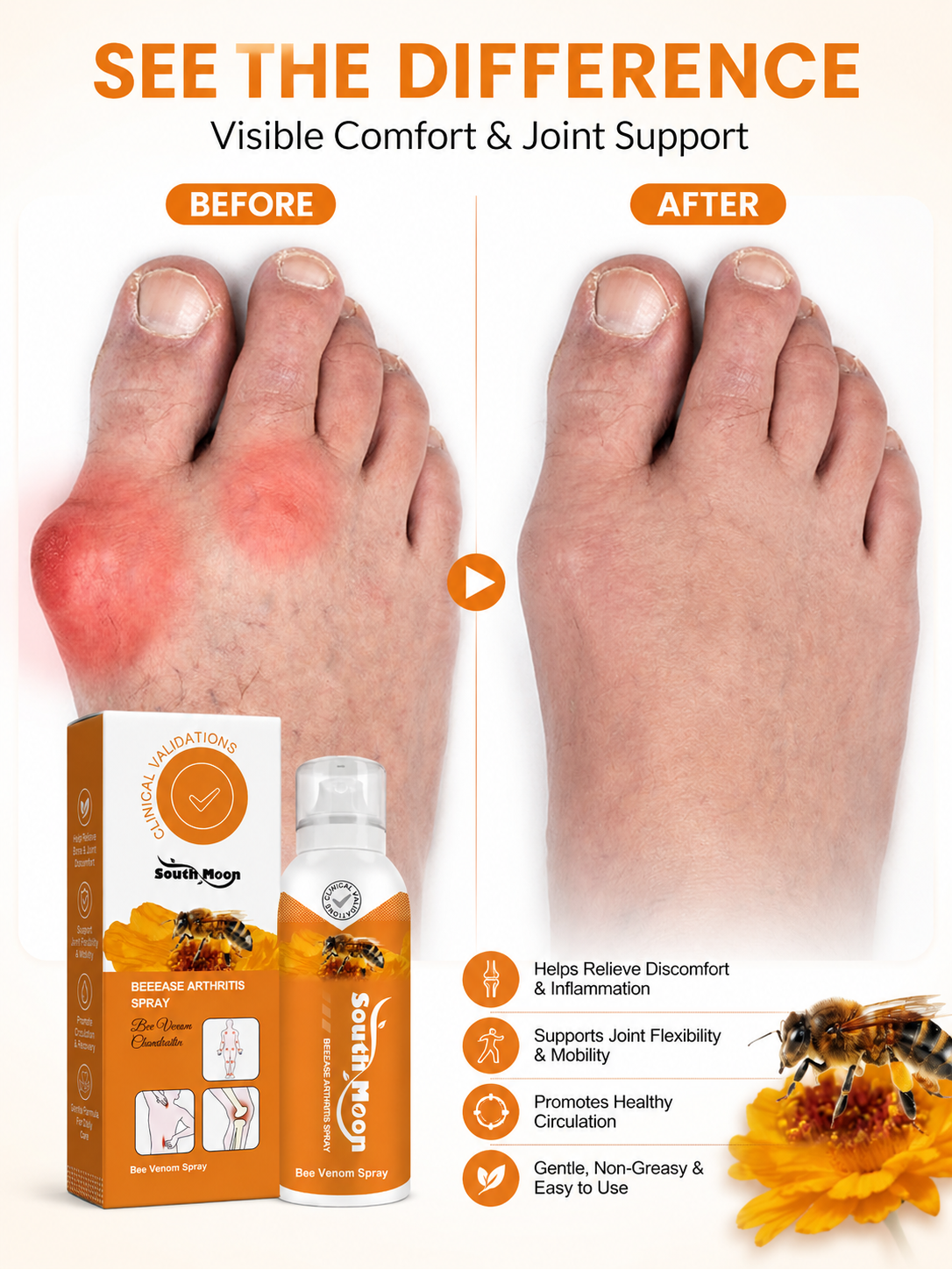 Bee Venom Joint Spray For Joints