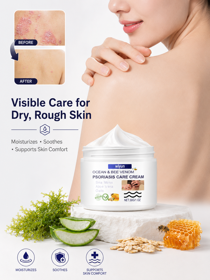 Bee Venom Moss Cream — Soothing Relief for Itchy Hands & Feet