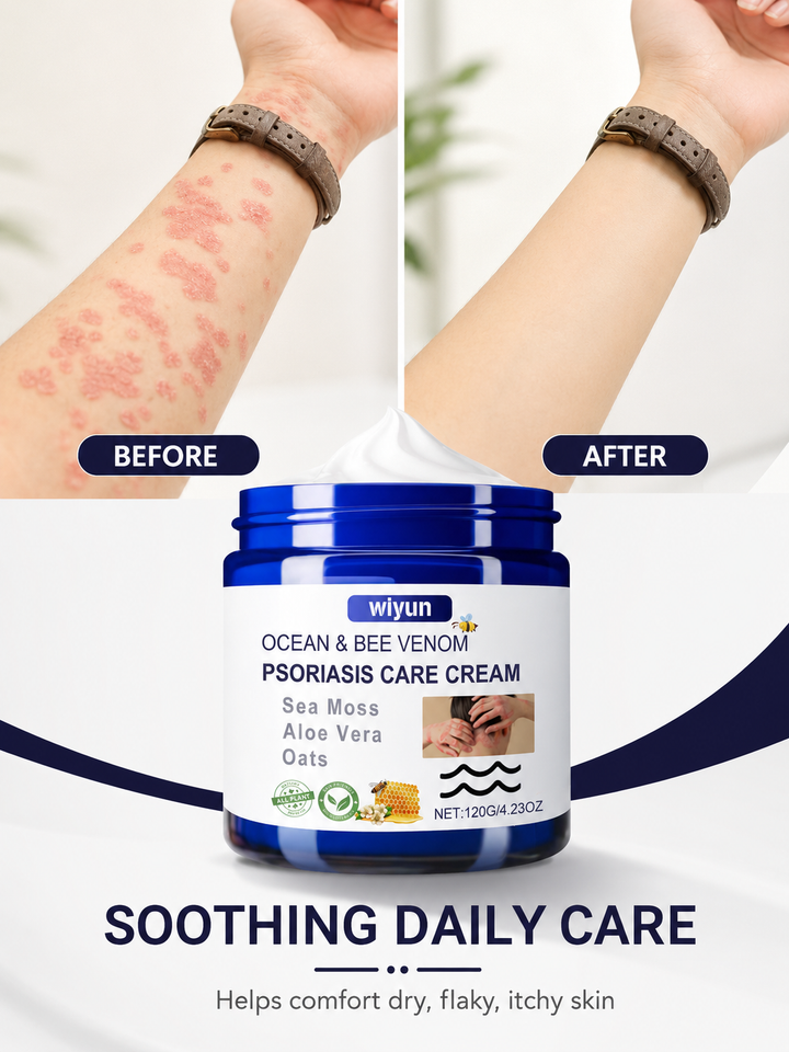 Moisturizer for Itchy Skin — Gentle Bee Venom Cream