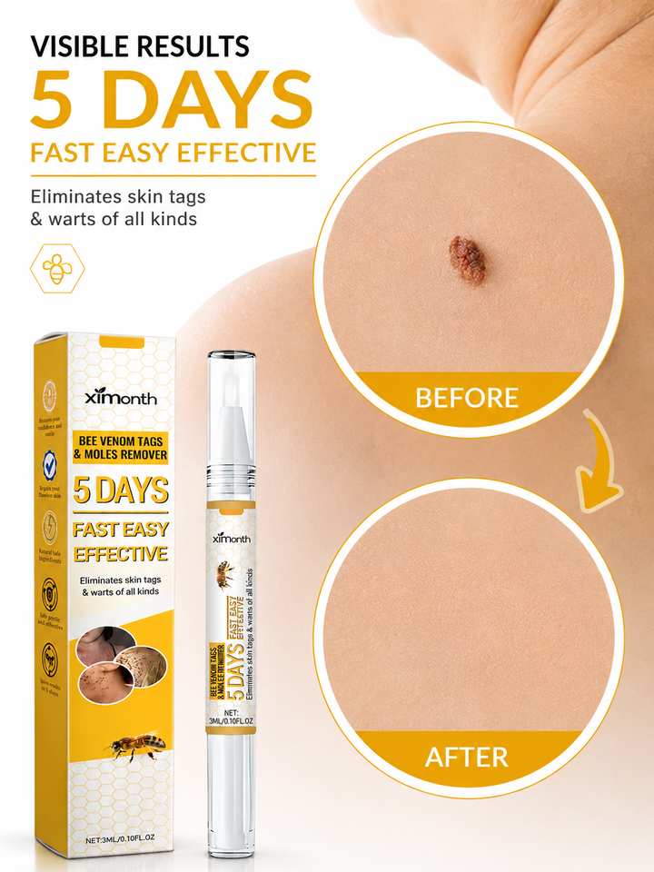 Bee Venom Skin Tag Removal Pen — 5-Day Treatment