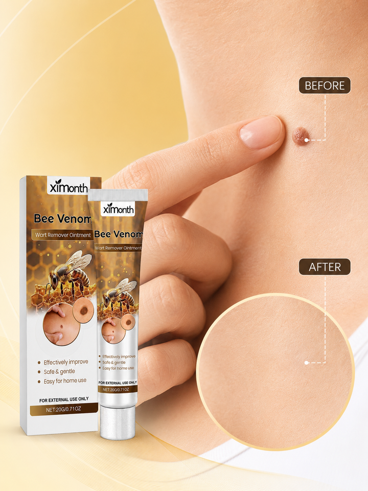 Bee Venom Wart Remover Ointment — Gentle Blemish Treatment