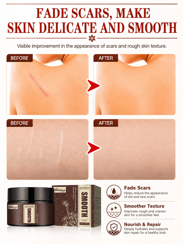 Centella Asiatica Scar Repair Cream — Fade Scars & Smooth Skin