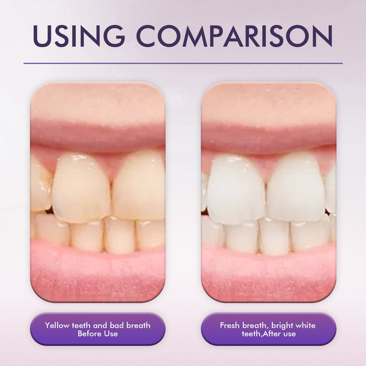 Whitening Toothpaste for Stains and Fresher Breath