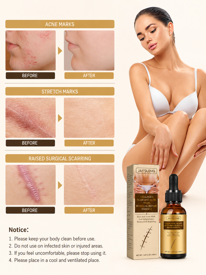 Collagen Scar Repair Oil — Fades Burns, Marks & Scars