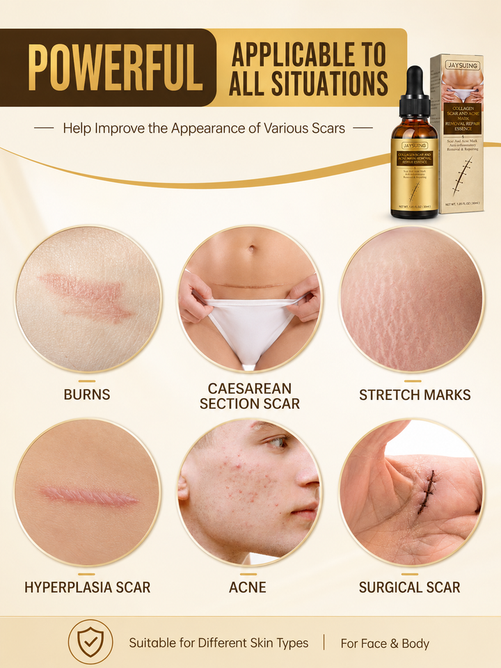 Collagen Scar Repair Oil — Fades Burns, Marks & Scars
