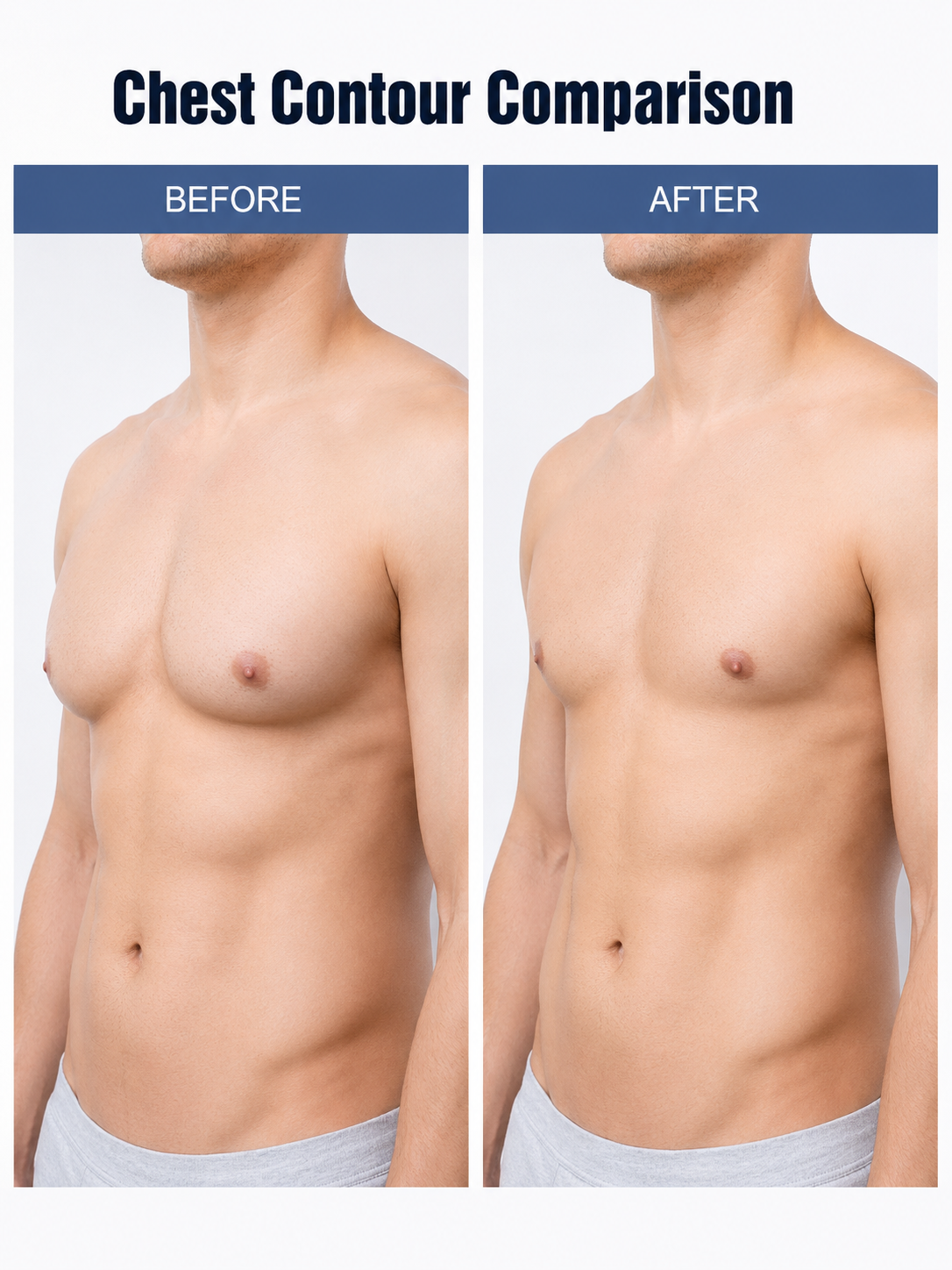Men's Chest Firming Patch — Gynecomastia Reduction