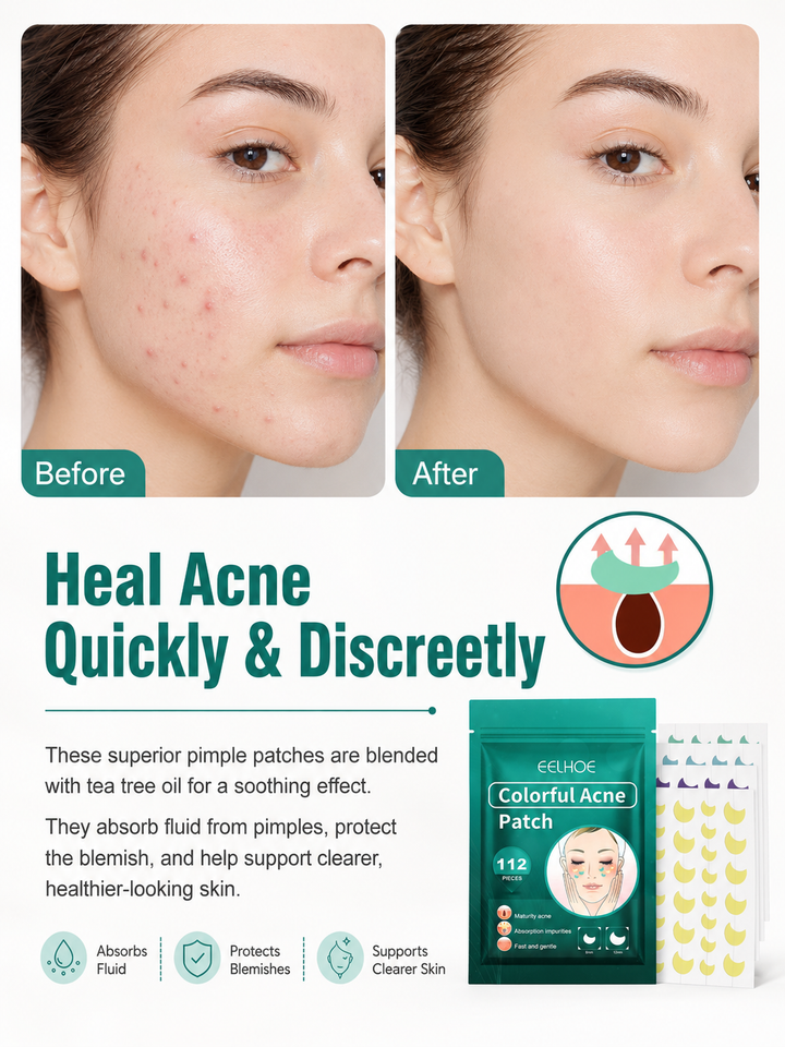 EELHOE Colorful Acne Patches 112pc — Tea Tree Hydrocolloid
