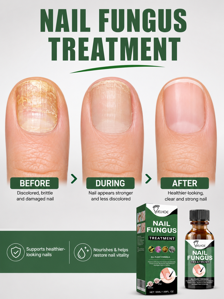 EELHOE Natural Antifungal Nail Treatment Liquid 50ml