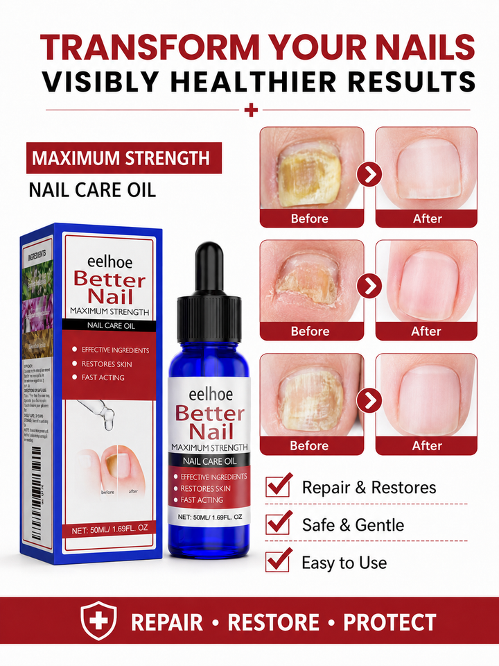 EELHOE Nail Repair Oil – Maximum Strength Fungal Treatment
