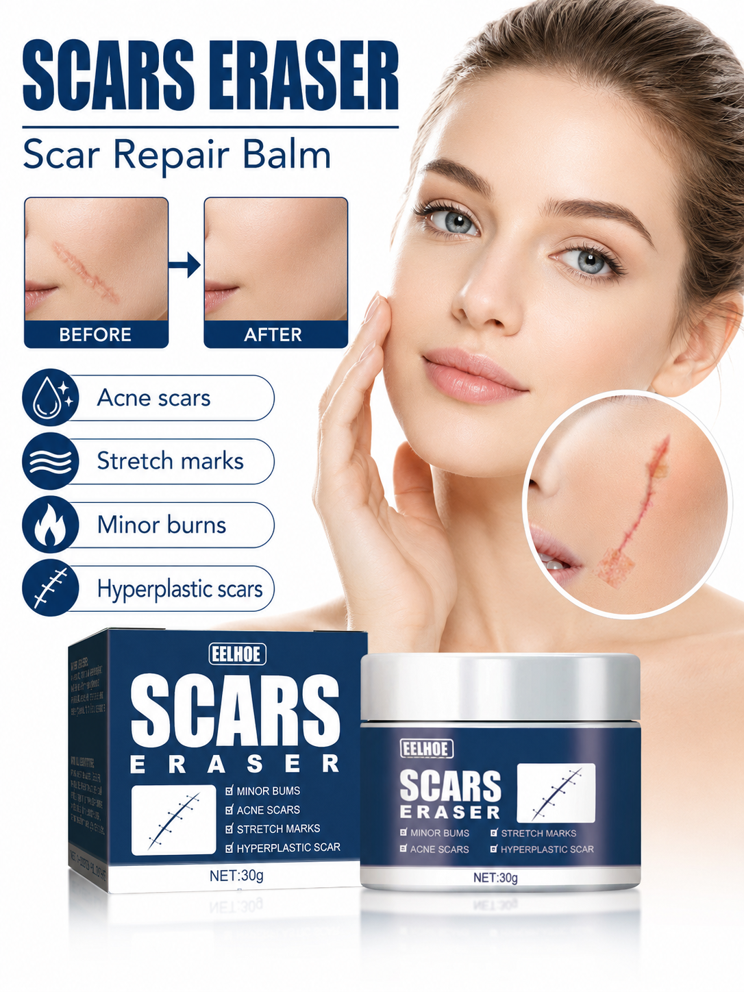 Scar Balm for Surgical Scars — Visible Fading in Weeks