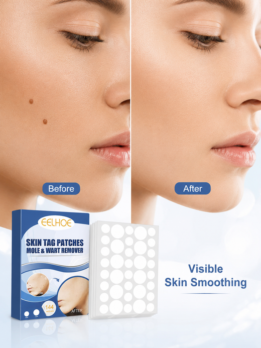 Skin Tag Patches – 144 Gentle Mole & Wart Removal Patches
