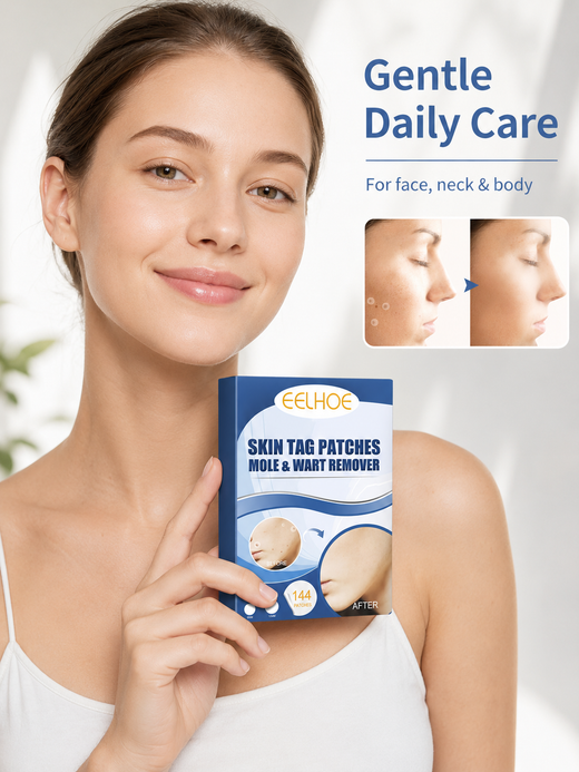 Skin Tag Patches – 144 Gentle Mole & Wart Removal Patches