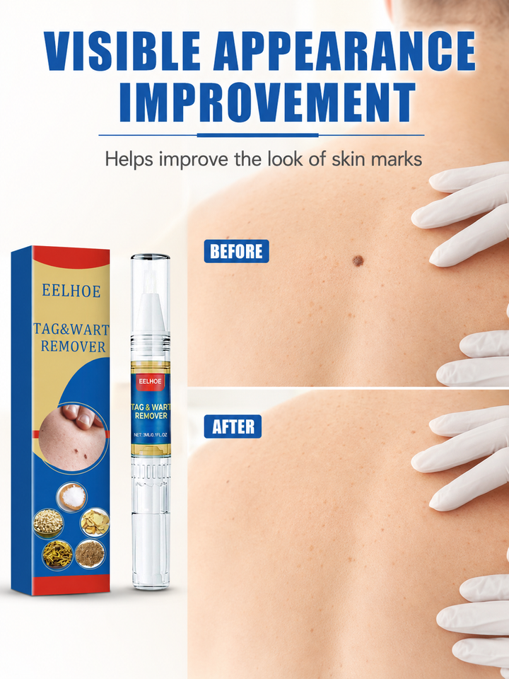 Skin Tag & Wart Remover Pen — Botanical Precision Formula