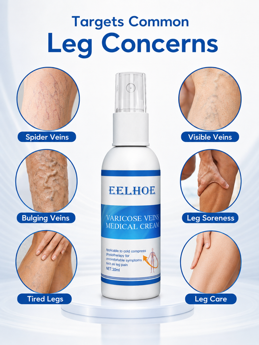 Varicose Veins Relief Spray – Rapid Leg Pain & Spider Vein