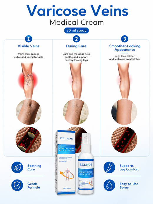 Varicose Veins Relief Spray – Rapid Leg Pain & Spider Vein