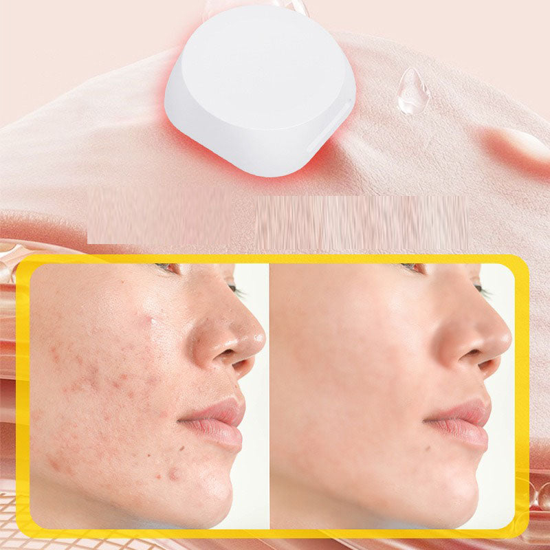 LED Acne Spot Patch with Red and Blue Light, 6 Pack