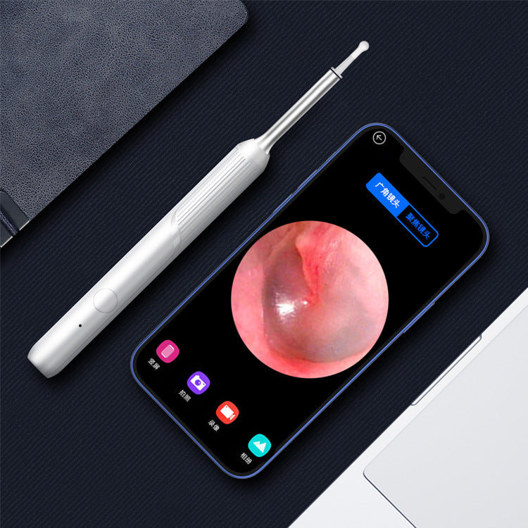 Endoscopic Ear Spoon with Camera and Phone Live View