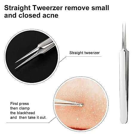 Professional Blackhead Tweezers - wanelo - store - roman