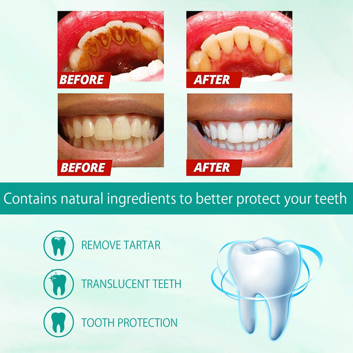 Foam Toothpaste for Whiter Teeth and Fresh Breath