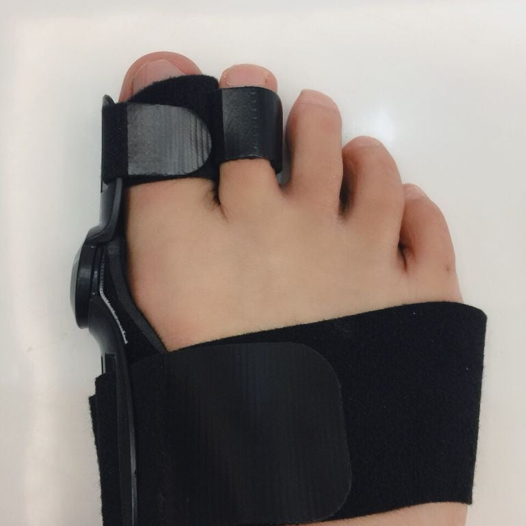 Bunion Corrector for Day & Night Use — Hallux Valgus Relief