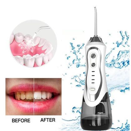 Oral Irrigators: Cordless Water Flossers for Healthy Gums & Teeth