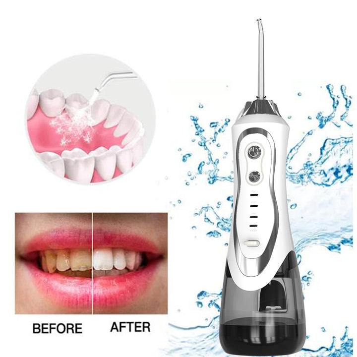 Portable Water Flosser – Dentist-Clean Teeth in Under a Minute