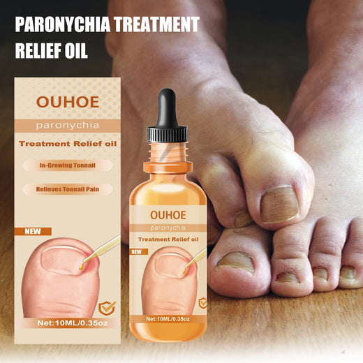 Nail Treatment Oil — Relieves In‑Growing Toenails &