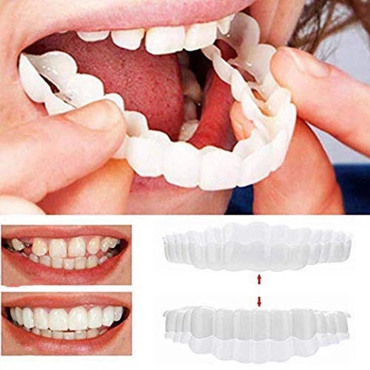 Costume Dental Braces — Realistic Fake Teeth, Upper & Lower
