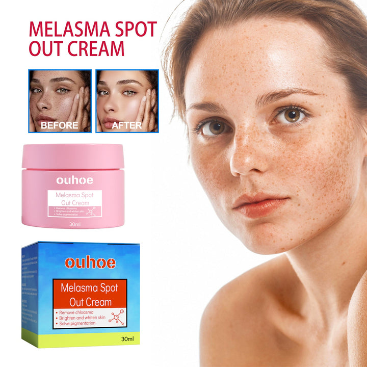 Melasma Spot Cream for Dark Spots & Uneven Tone