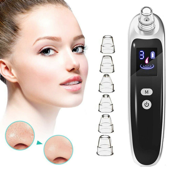Pore Vacuum Blackhead Remover – Deep Cleansing & Clearer Skin