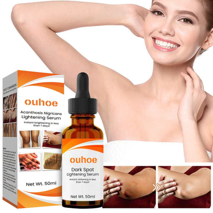 Skin Lightening Serum — Brighter, Even Tone in 7 Days