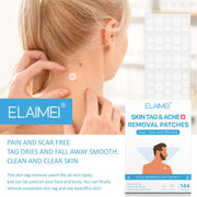 Woman applying patch to neck skin tag; large ELAIMEI branding with blue bar; packaging shown on right with 144 patch count visible