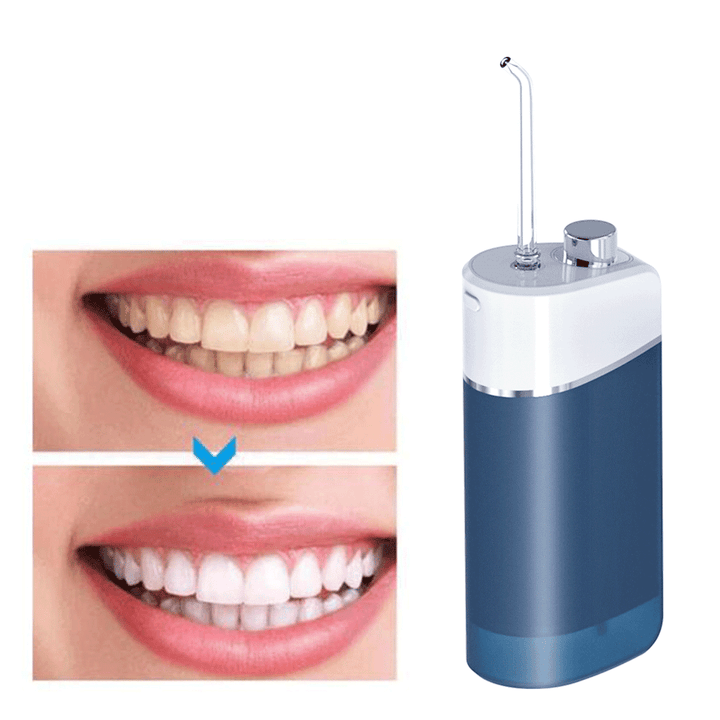Water Flosser Portable — Professional Plaque Removal & Gum