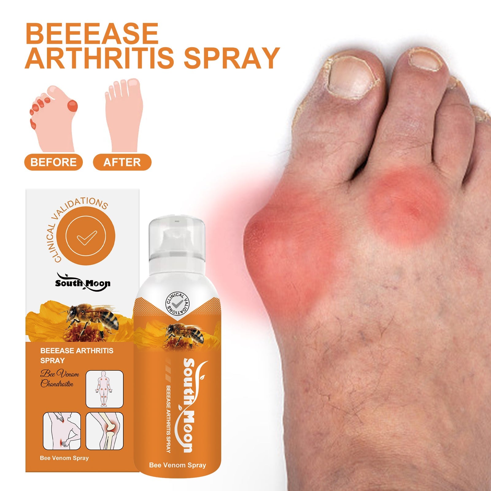 BEEASE Arthritis Spray branding with before/after foot comparison and product bottle display