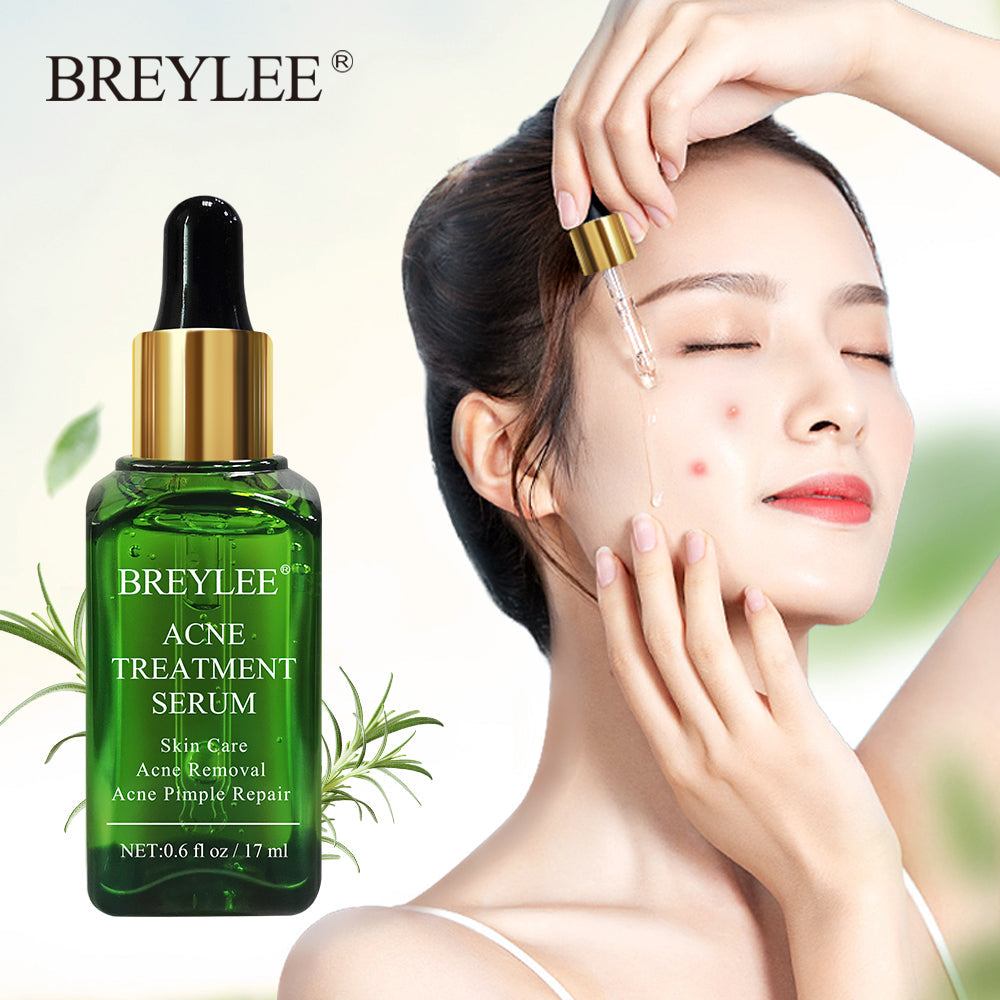 BREYLEE Acne Treatment Serum bottle with gold cap shown alongside lifestyle image of woman applying serum to forehead with dropper, showing product in use