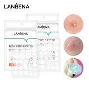 LANBENA Acne Pimple Patch packaging showing day and night formulas with patch counts and size specifications displayed