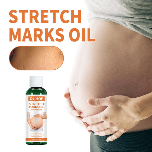 Pregnancy Massage Oil – Prevent & Lighten Stretch Marks Naturally