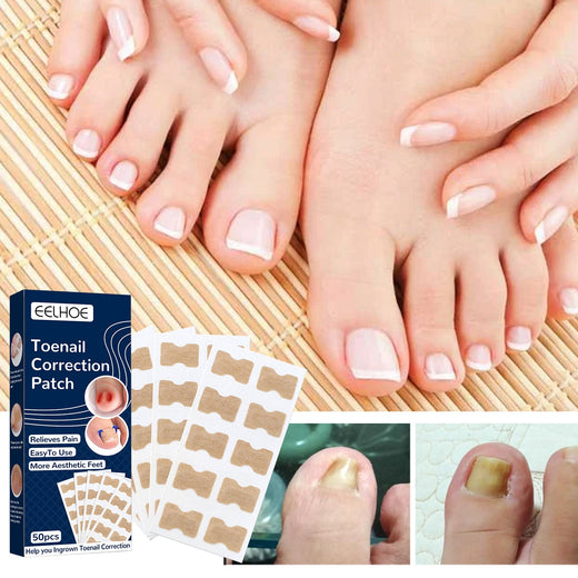 Ingrown Toenail Correction Patch Kit - Pain Relief 50pk